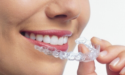 マウスピースを持つ女性の口元